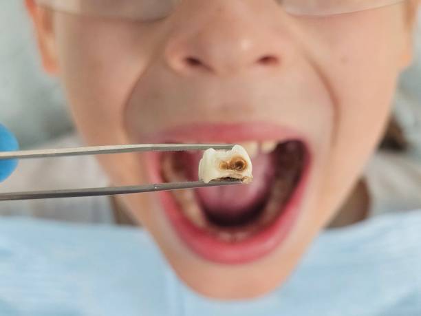 Best Mobile Emergency Dentist in Harker Heights, TX