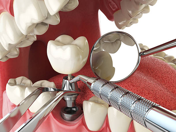 Best Holiday Emergency Dentist in Harker Heights, TX